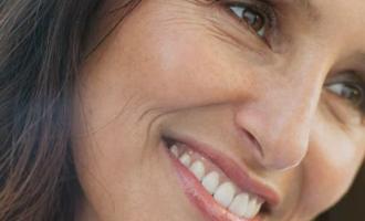 BOTOX – gubice okoli oči